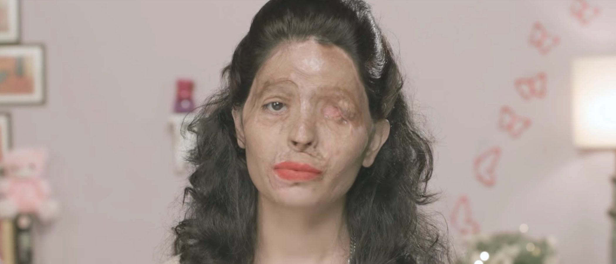 La Semana de la Moda de Nueva York tiene nueva modelo: una víctima de un ataque con ácido