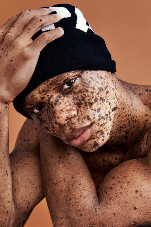 El modelo masculino Ralph Souffrant participa en la campaña publicitaria Ivy Park de otoño/invierno 2017/2018